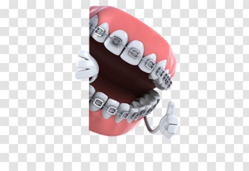 Dentistry Orthodontics Dental Braces Tooth Medicine - Health Transparent PNG