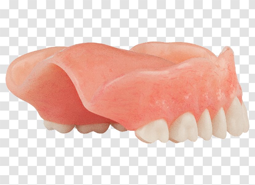 Tooth Dentures Dentistry Jaw Dental Implant - Bone Density - Aspen Transparent PNG