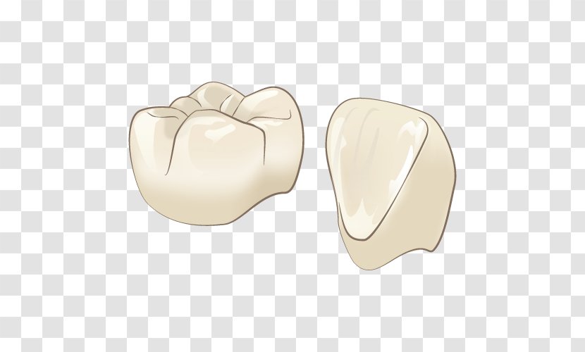 Dentistry Therapy 審美歯科 Tooth - Crown Transparent PNG