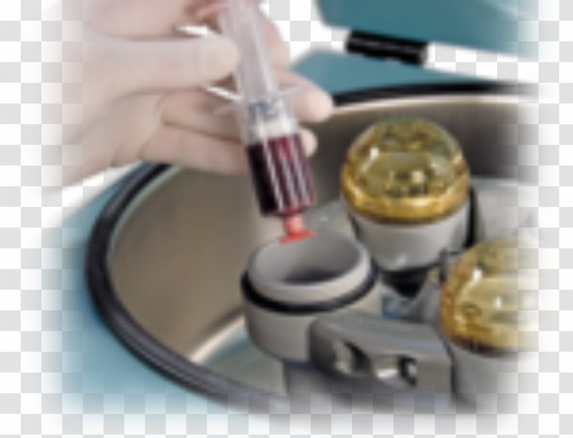 Platelet-rich Plasma Therapy Patient Medicine - Arthrex - Service Transparent PNG