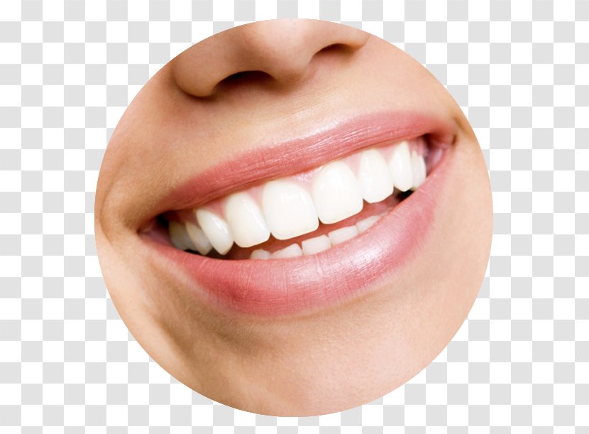 Tooth Whitening Cosmetic Dentistry Human - Dental Smile Transparent PNG