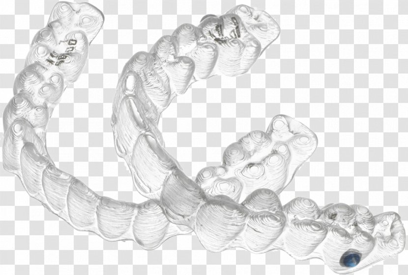 Clear Aligners Contemporary Orthodontics Dentistry Dental Braces - Silver - Child Transparent PNG