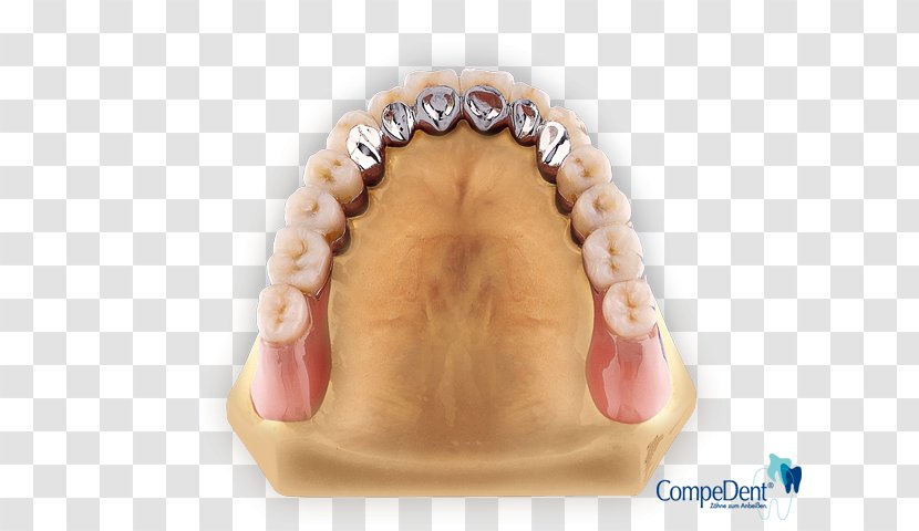 Tooth Dental Laboratory Dentures Removable Partial Denture Dentallabor Klein GmbH - Technician Transparent PNG