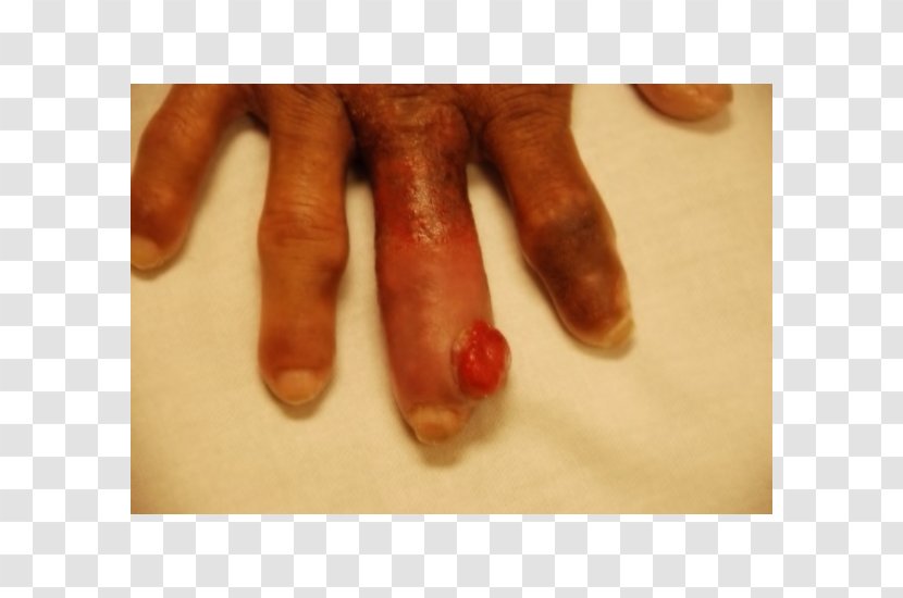 Hand Model Finger Nail Thumb - Heart - Soft Feet Transparent PNG