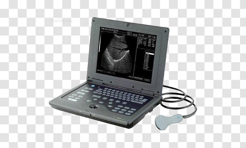 Ultrasonography Medicine Ultrasound Image Scanner Medical Diagnosis - Electronic Device - Luxury Logos Transparent PNG