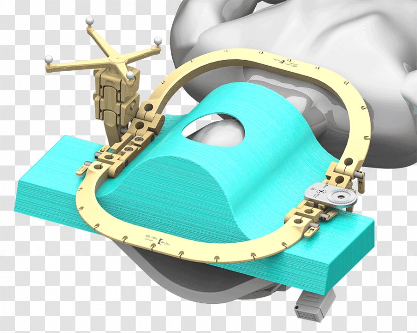 Neurosurgery Magnetic Resonance Imaging Brainlab Intraoperative MRI Craniotomy - Film - Modellversuch Transparent PNG