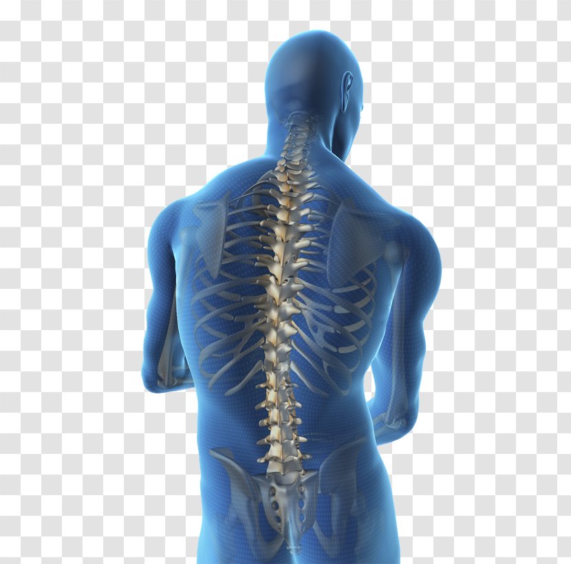 Vertebral Column Spinal Cord Human Back Body Stenosis - Cartoon - Frame Transparent PNG