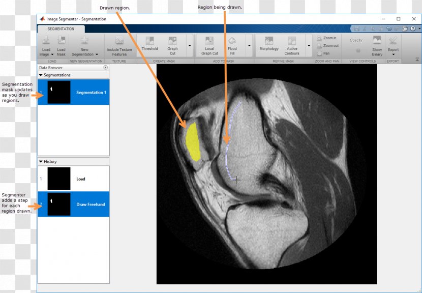 Image Segmentation Thresholding MATLAB Binary - Simulink Transparent PNG