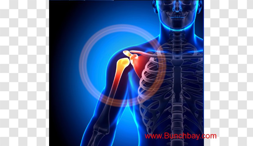 Shoulder Pain Joint Impingement Syndrome Injury - Human Transparent PNG