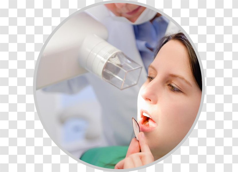 Dentistry X-ray Dental Radiography Tooth - Injection - Tecnic Transparent PNG