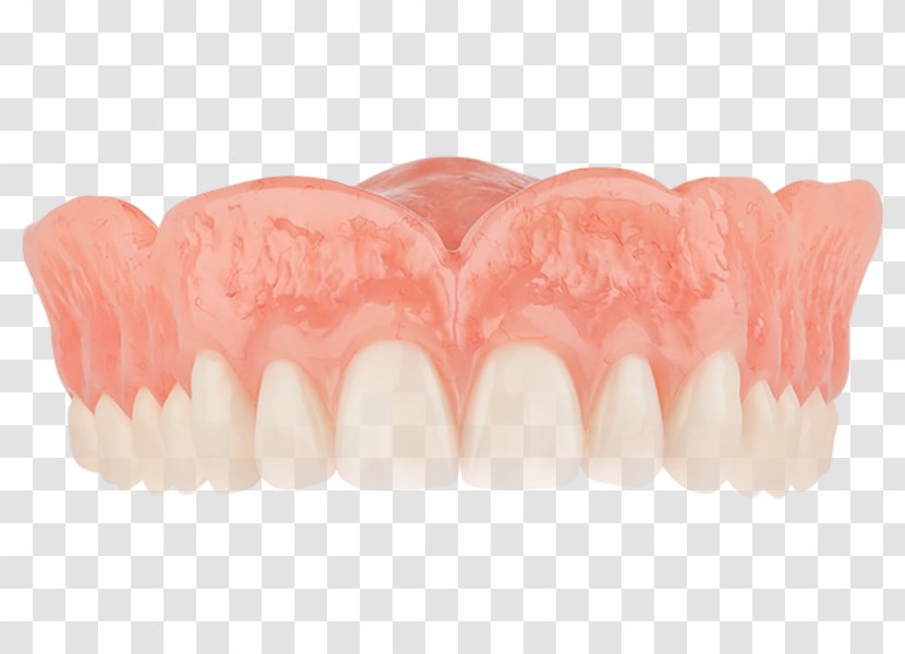 Dentures Tooth Dentistry Removable Partial Denture - Aspen Dental - Crown Transparent PNG