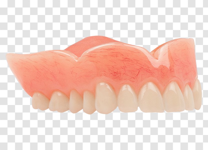Dentures Tooth Dentistry Aspen Dental Acrylic Resin - Classic Transparent PNG