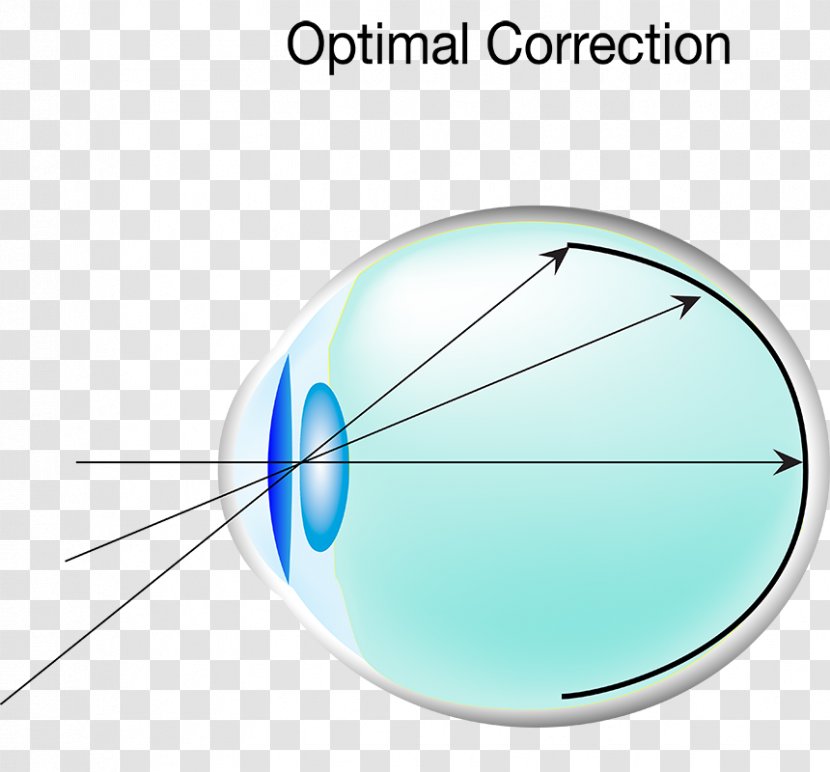 Circle Angle - Microsoft Azure - Myopia Transparent PNG