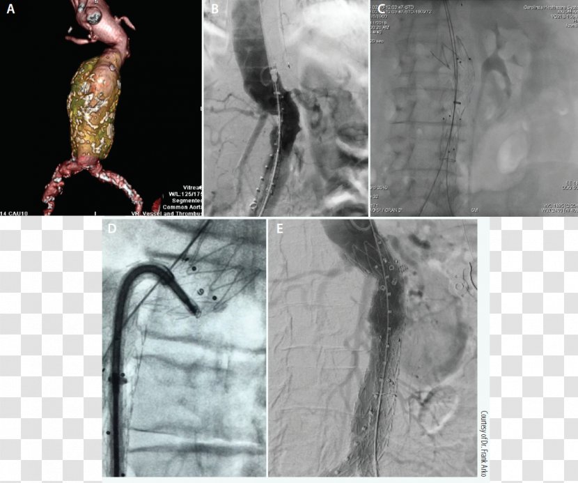 Medical Imaging Homo Sapiens Medicine White Magnetic Resonance - Asymptomatic Transparent PNG