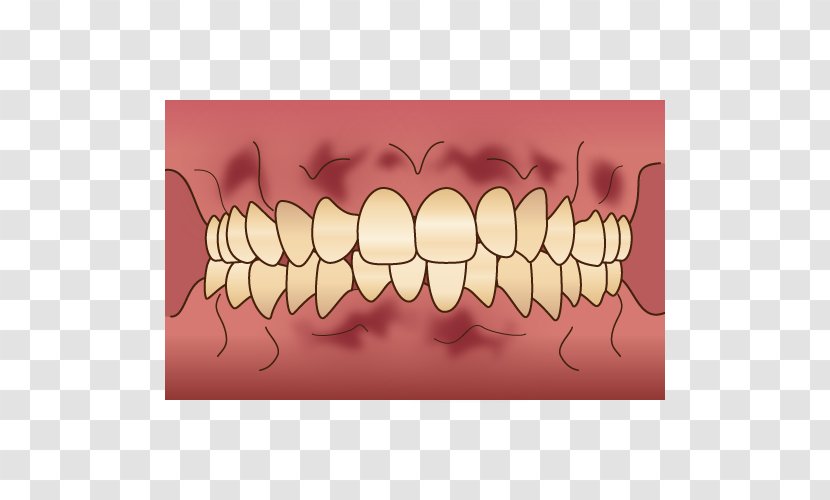 Tooth 審美歯科 Dentist Gums - Watercolor - Dental Flyer Transparent PNG
