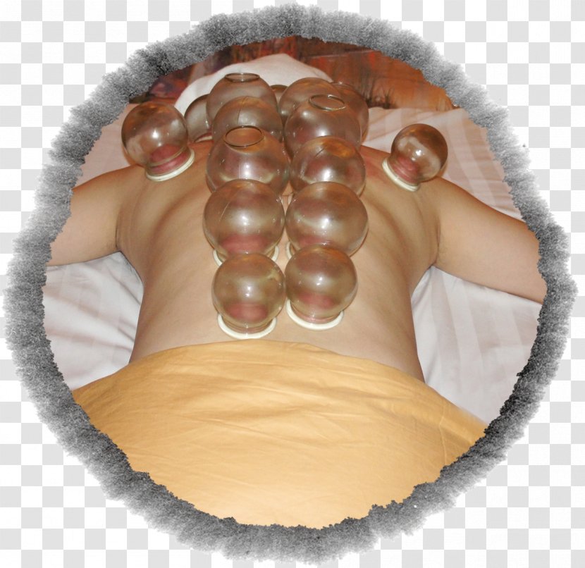 Cupping Therapy Health Running Fitness - String - Culture Transparent PNG