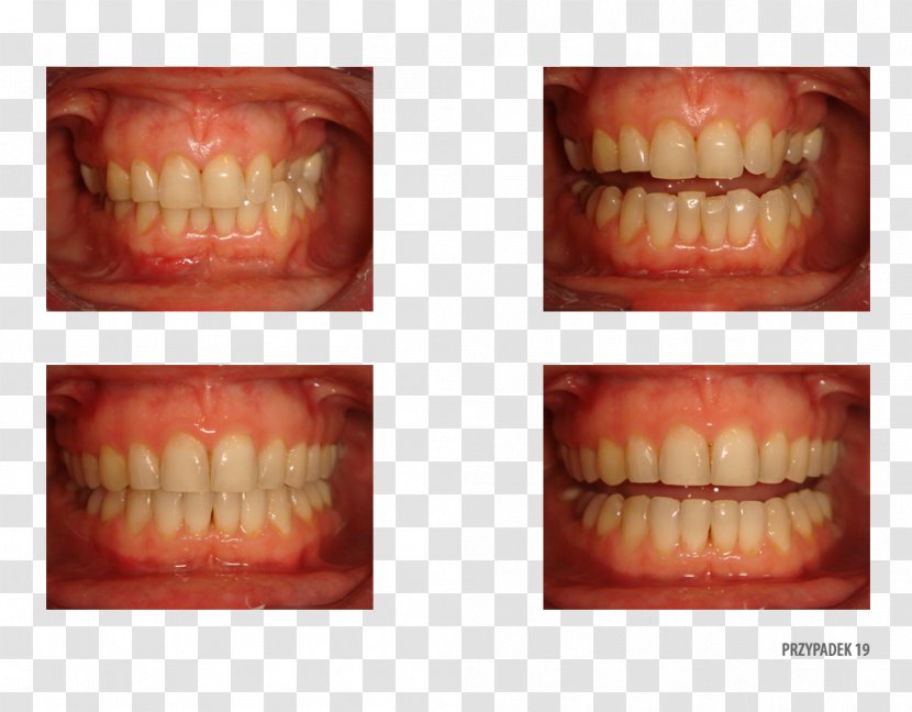 Tooth Therapy Patient Service Quality - Jaw Transparent PNG
