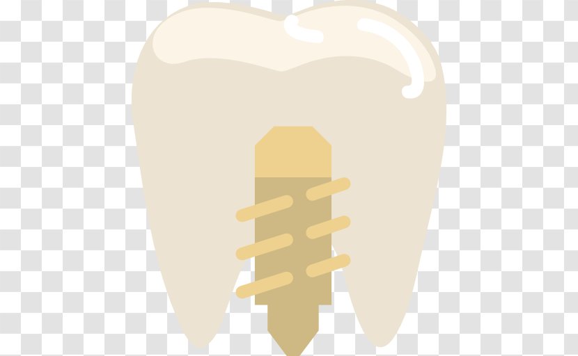 Tooth Dentistry - Cartoon - Implants Transparent PNG