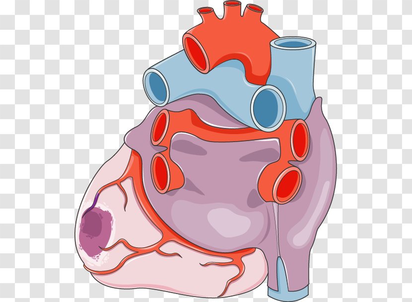 Heart Acute Myocardial Infarction Circulatory System Cardiovascular Disease - Watercolor Transparent PNG
