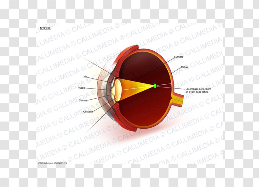 Far-sightedness Ophthalmology Presbyopia Macular Degeneration Eye - Farsightedness - Myopia Transparent PNG