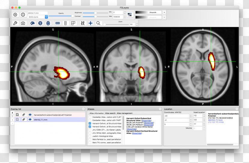 Brain Computed Tomography Neuroimaging - Silhouette Transparent PNG