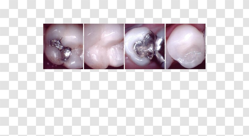 Product Desktop Wallpaper Close-up Computer - Ear - Dental Treatment Transparent PNG