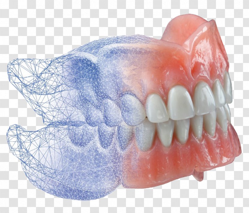 AvaDent Dentures CAD/CAM Dentistry - Tooth - Crowns Transparent PNG