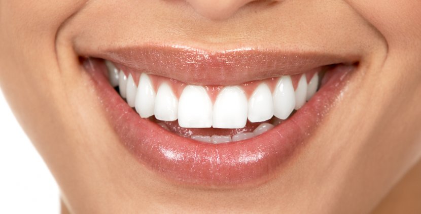Dentistry The Park Practice Tooth Whitening Dental Surgery - Cosmetic - Teeth Transparent PNG