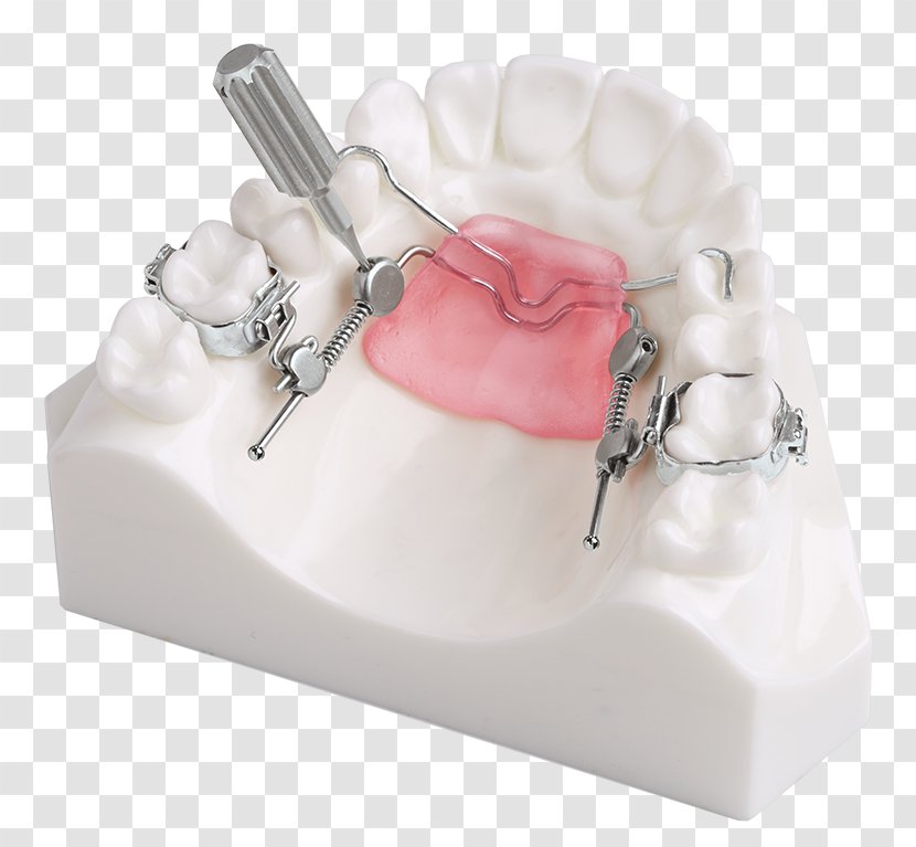 DynaFlex Orthodontics International Plaza Court Orthodontic Technology - Jaw - Dental Braces Transparent PNG