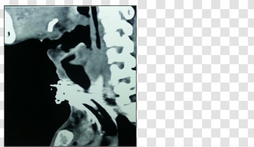 Visual Arts Medical Imaging Stencil Monochrome - Black M - Neck Bloodstain Transparent PNG