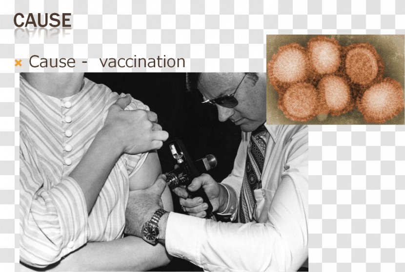 Spanish Flu Swine Influenza Gripiviirused Pandemic - Smallpox Transparent PNG
