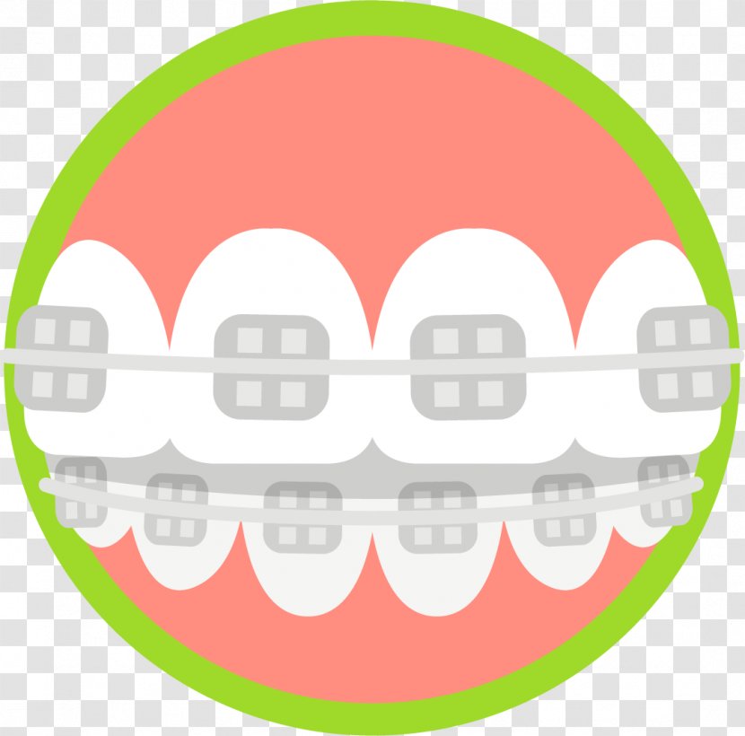 Cosmetic Dentistry Tooth Health Orthodontics - Jaw - Dental Braces Transparent PNG