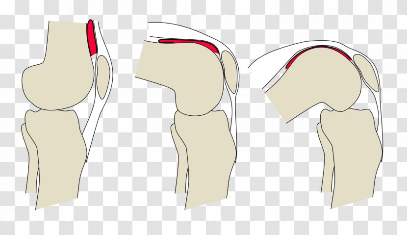 Articular Capsule Of The Knee Joint Synovial - Tree - Arthritis Transparent PNG