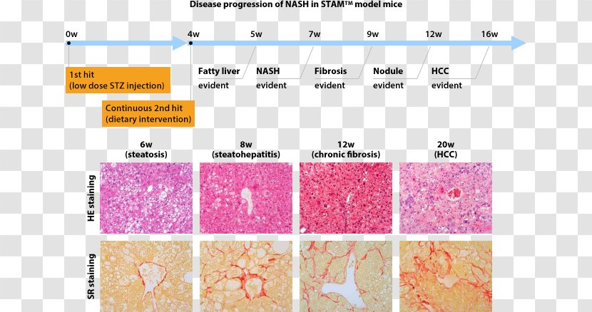 Non-alcoholic Fatty Liver Disease Computer Mouse Model Degeneration - Nonalcoholic - Pathology Lab Transparent PNG