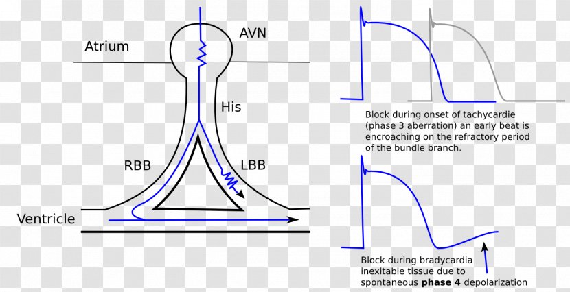 Left Bundle Branch Block Right Branches Electrical Conduction System Of The Heart - Watercolor - Tree Transparent PNG