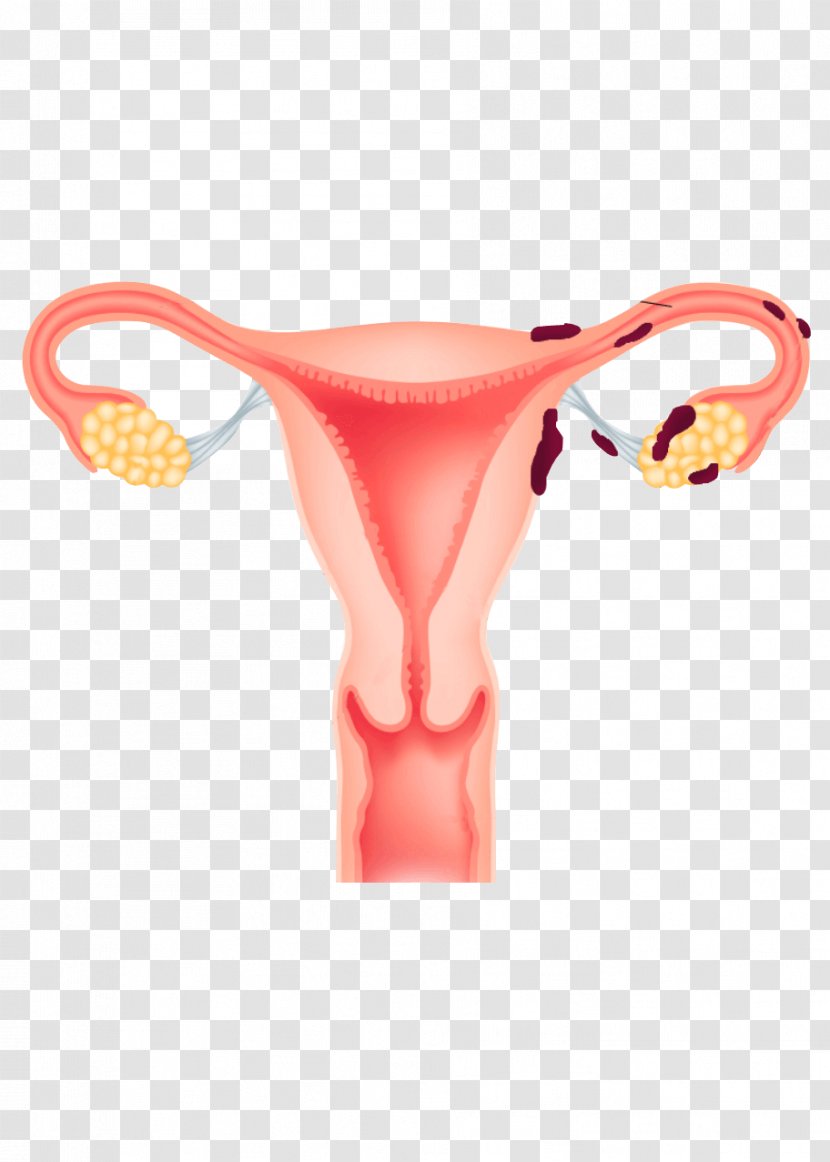Endometrium Endometriosis Uterus Menstruation Ovary - Heart - Silhouette Transparent PNG