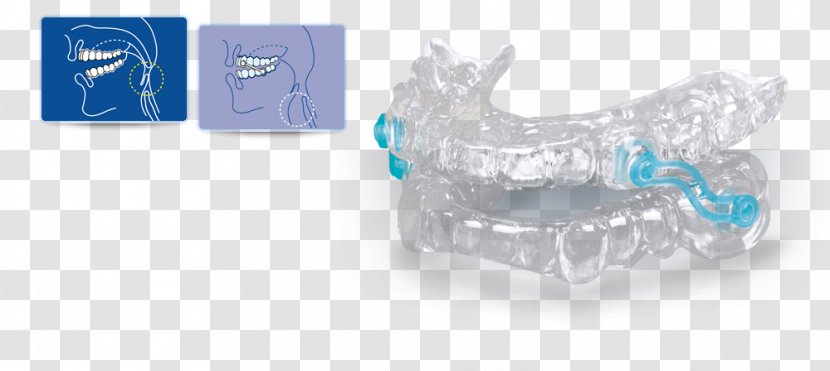 Snoring Dentistry Apnea Upper Airway Resistance Syndrome - Body Jewelry - Open An Account Freely Transparent PNG