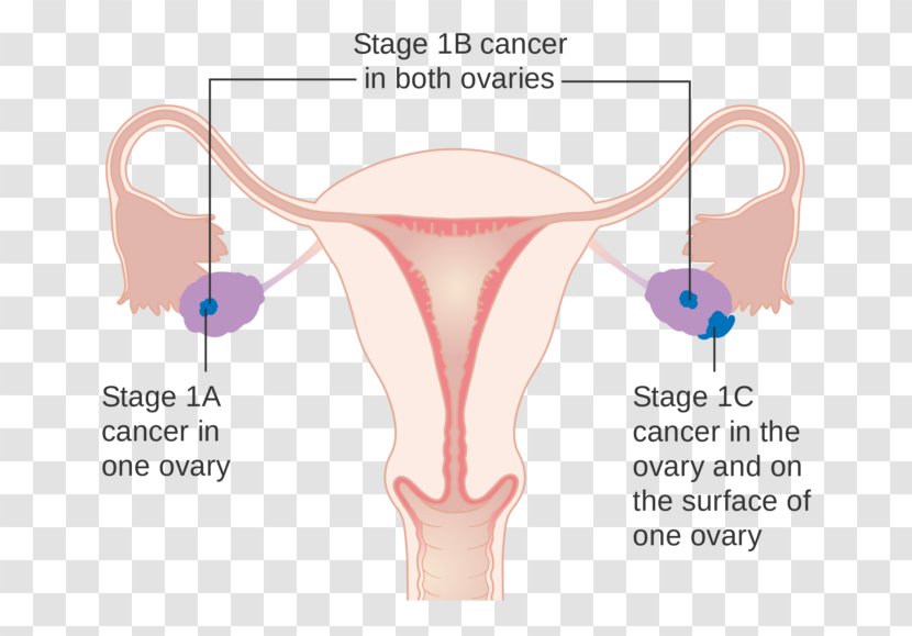Ovarian Cancer Staging Ovary Research UK - Flower - Frame Transparent PNG