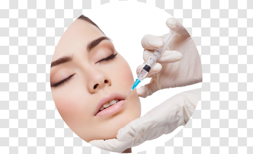 Injection Lip Surgery Skin Adverse Effect - Pharmaceutical Drug - Face Transparent PNG