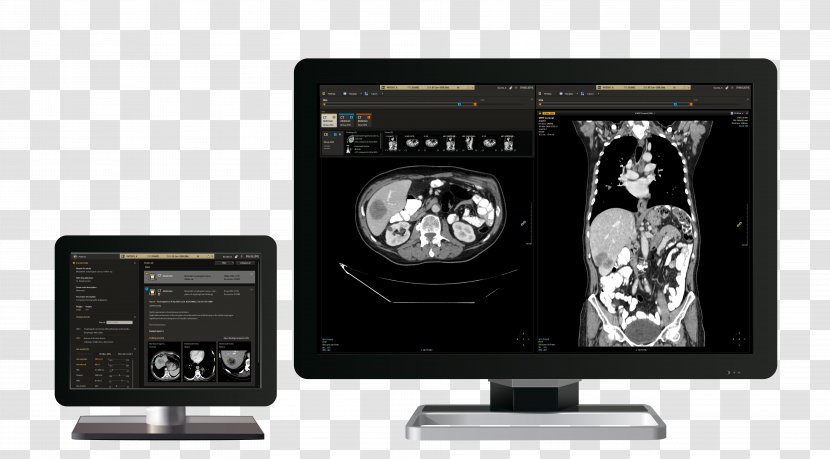 Picture Archiving And Communication System Philips Radiology Template Electronics - Wiring Diagram Transparent PNG