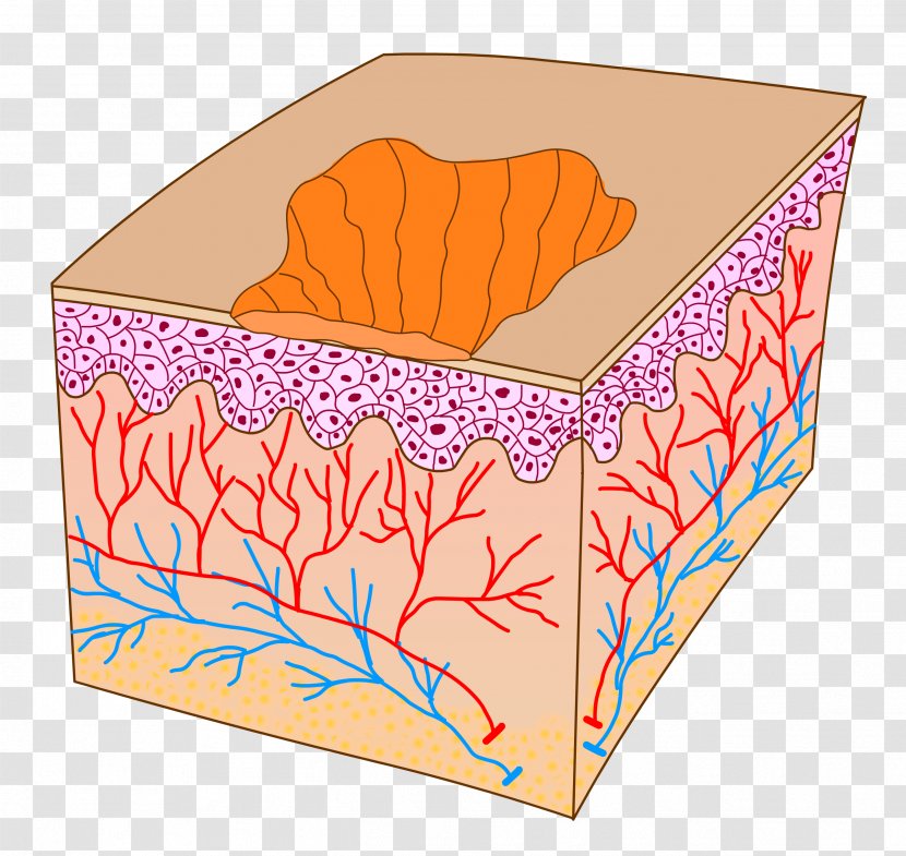 Fat Cartoon - Lipoma - Paper Product Transparent PNG