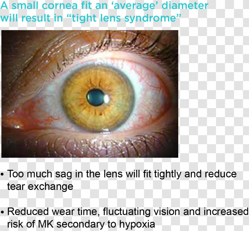 Iris Contact Lenses Cornea Circle Lens - Heart - Eye Transparent PNG