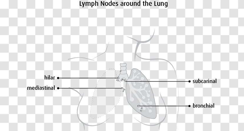 Lymph Node The Lymphatic System Mediastinum Lung - Watercolor - Cancer Cell Details Transparent PNG