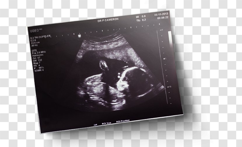 Brand - Poster - Sonography Transparent PNG