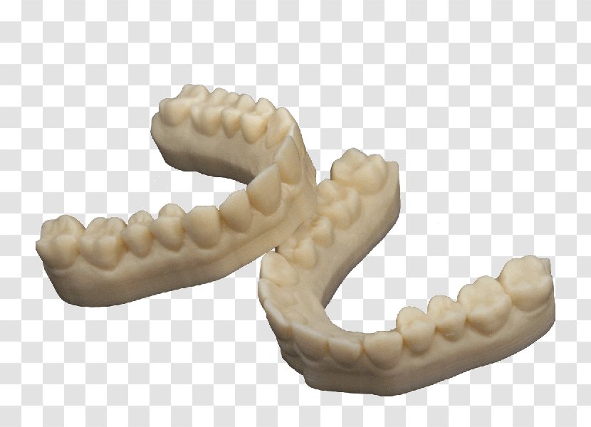 3D Printing Dentistry Dental Composite Crown - 3d Tooth Repair Transparent PNG