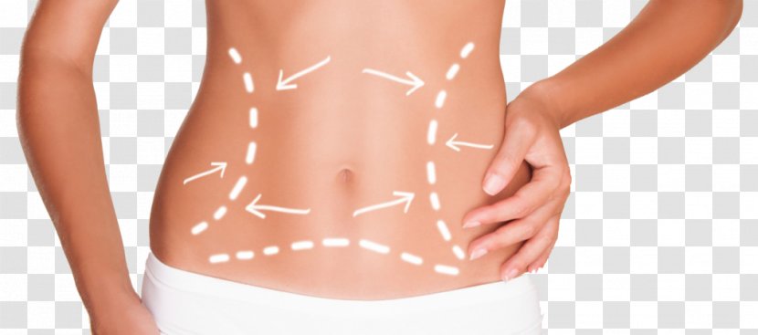 Abdomen Adipose Tissue Body Contouring Cryolipolysis Abdominoplasty - Frame Transparent PNG