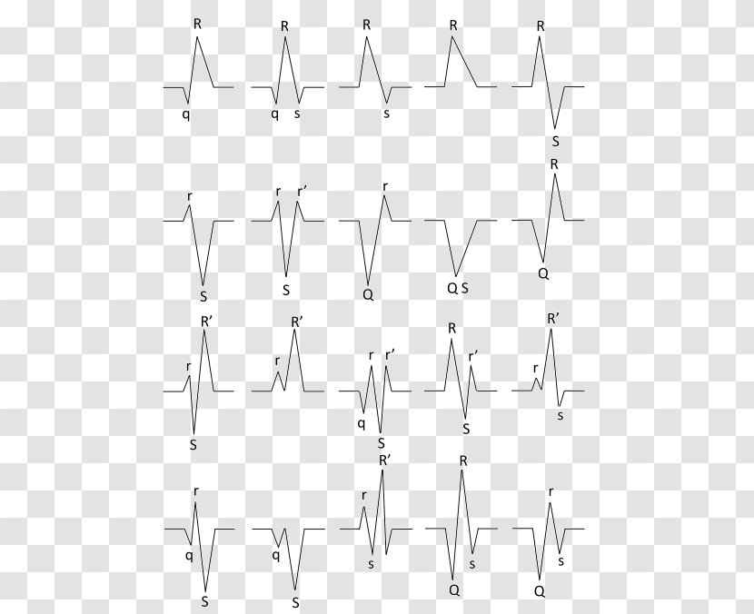 Product Angle Point Pattern Font - Diagram - Qrs Accessory Pathway Transparent PNG