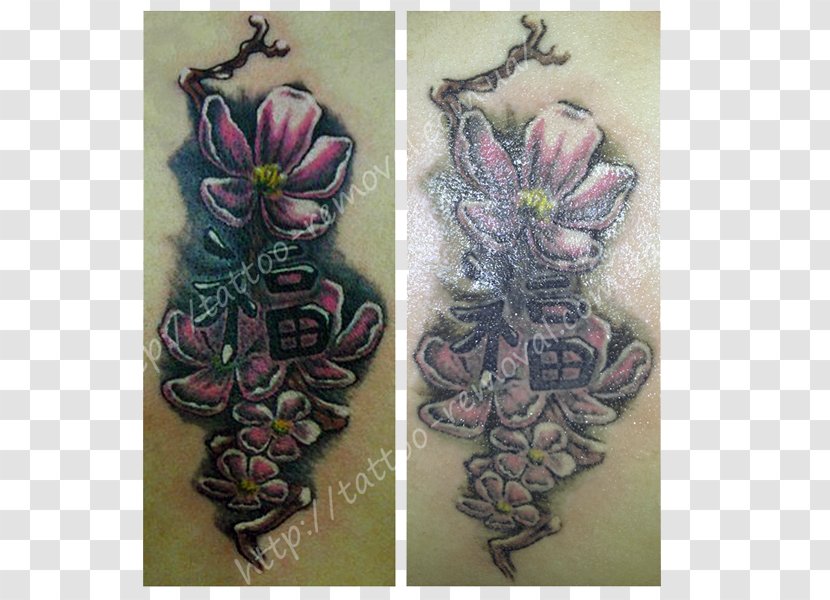 Tattoo Removal Cover-up Scar Udalenye Tatuyrovok Lazerom, Salon Stella - Kiev Transparent PNG