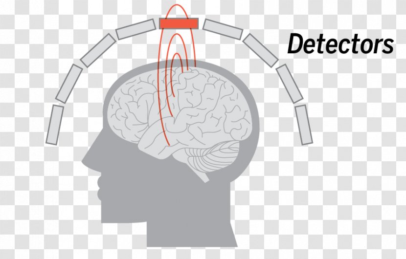 Brain Mapping Magnetoencephalography Neuroimaging Magnetic Field - Tree - Coronal Plane Transparent PNG