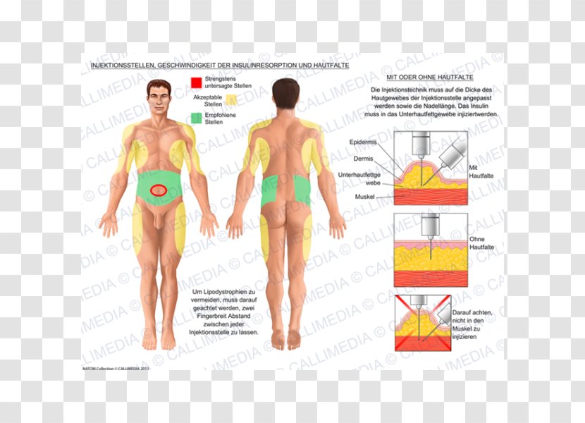 Insulin Subcutaneous Injection Disease Muscle - Flower Transparent PNG